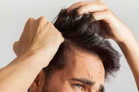 درمان ریزش مو ناشی از کبد چرب
