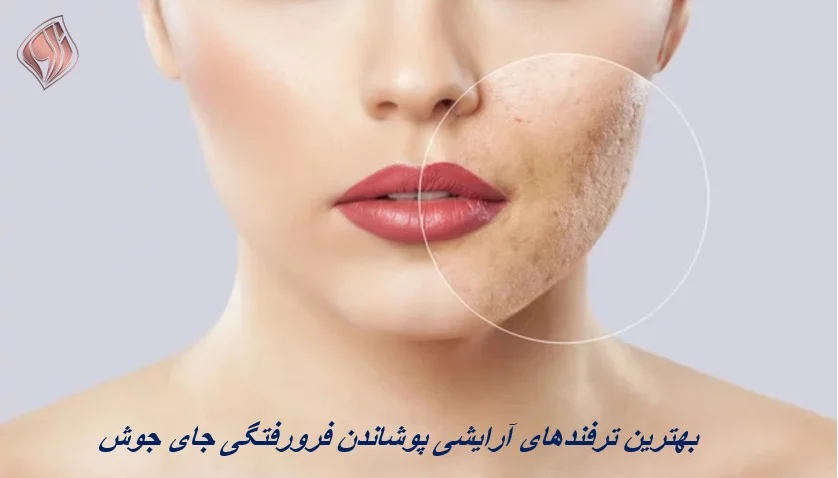بهترین ترفندهای آرایشی پوشاندن فرورفتگی جای جوش
