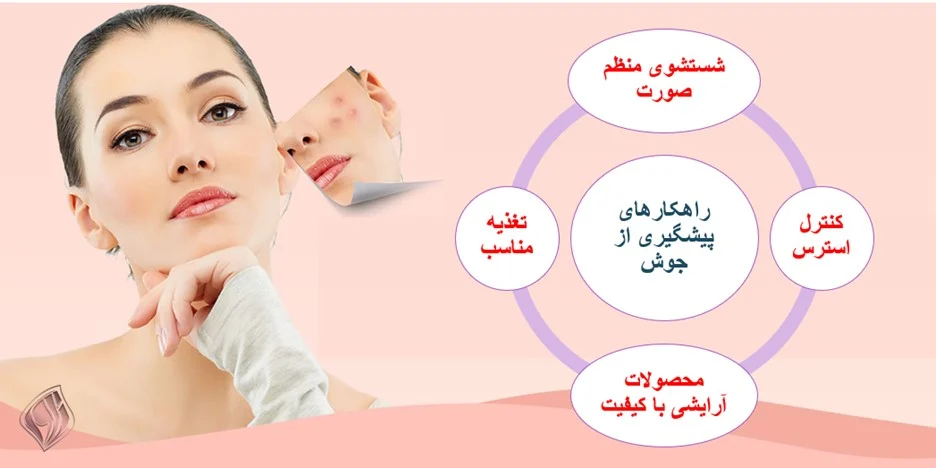 برای پیشگری از جای جوش صورت خود را مرتباً شست و شو دهید