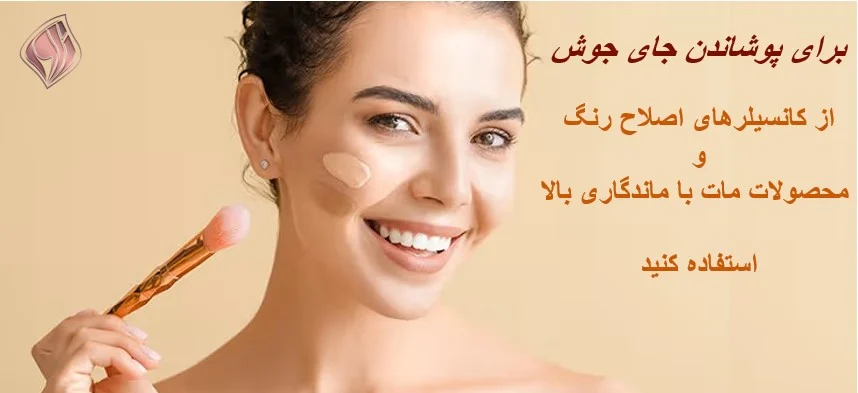 کانسیلر به پوشاندن جای جوش های شما کمک می کند