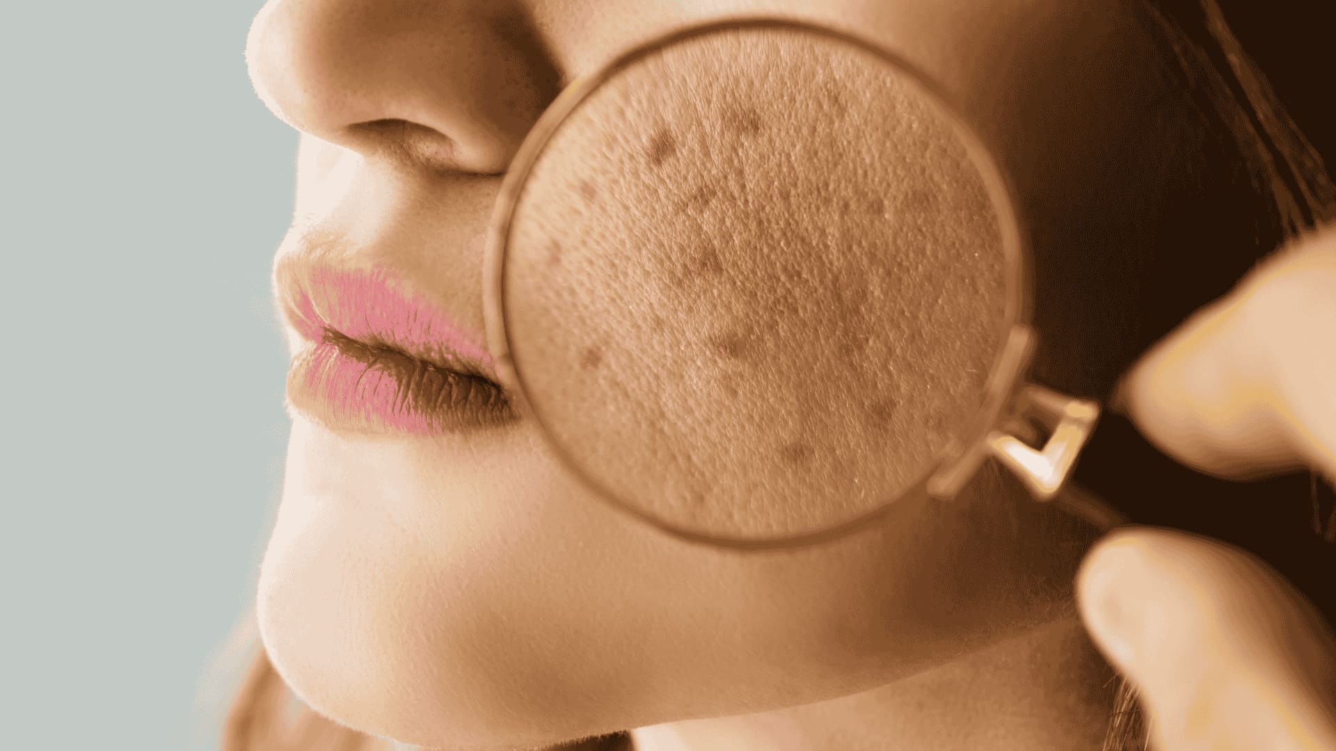چطور در کمتر از یک ماه جوش های صورتت رو محو کنیم؟