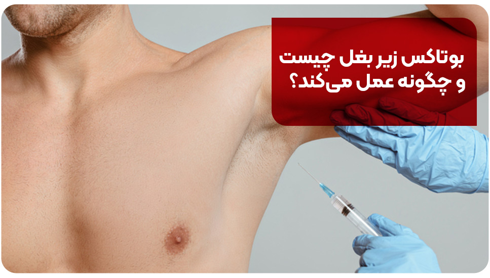 بوتاکس زیر بغل چیست و چگونه عمل می‌کند؟