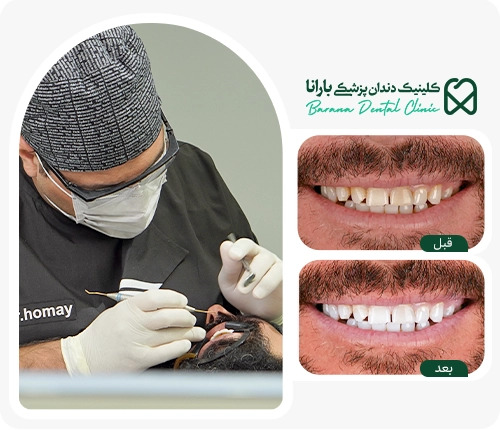 آیا جرم گیری دندان به مینای دندان آسیب می زند؟