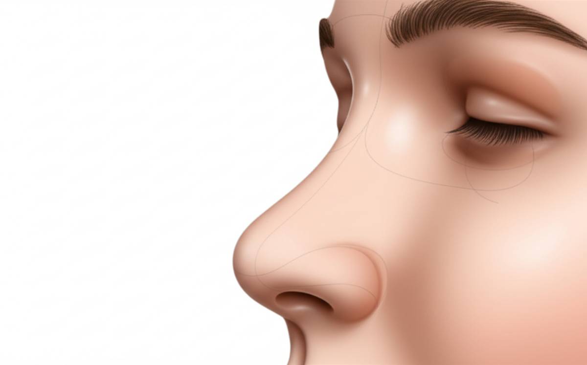 جراحی بینی استخوانی چگونه است ؟